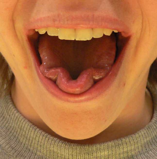 trixie tongue tricks